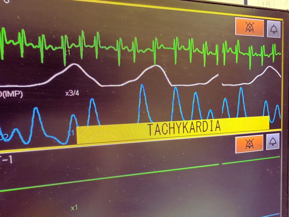 Kołatanie serca – kiedy to normalne, a kiedy nie?