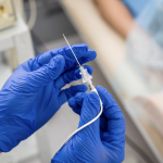 Ablacja ma na celu odizolowanie żył płucnych — miejsca, gdzie najczęściej powstaje arytmia.