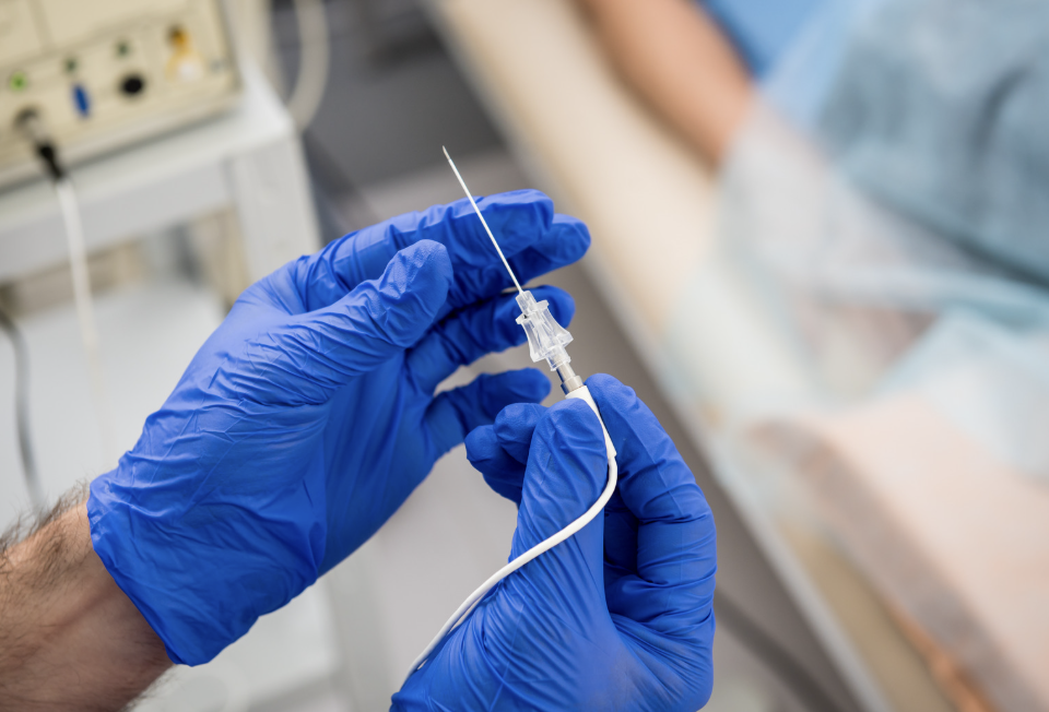 Ablacja ma na celu odizolowanie żył płucnych — miejsca, gdzie najczęściej powstaje arytmia.